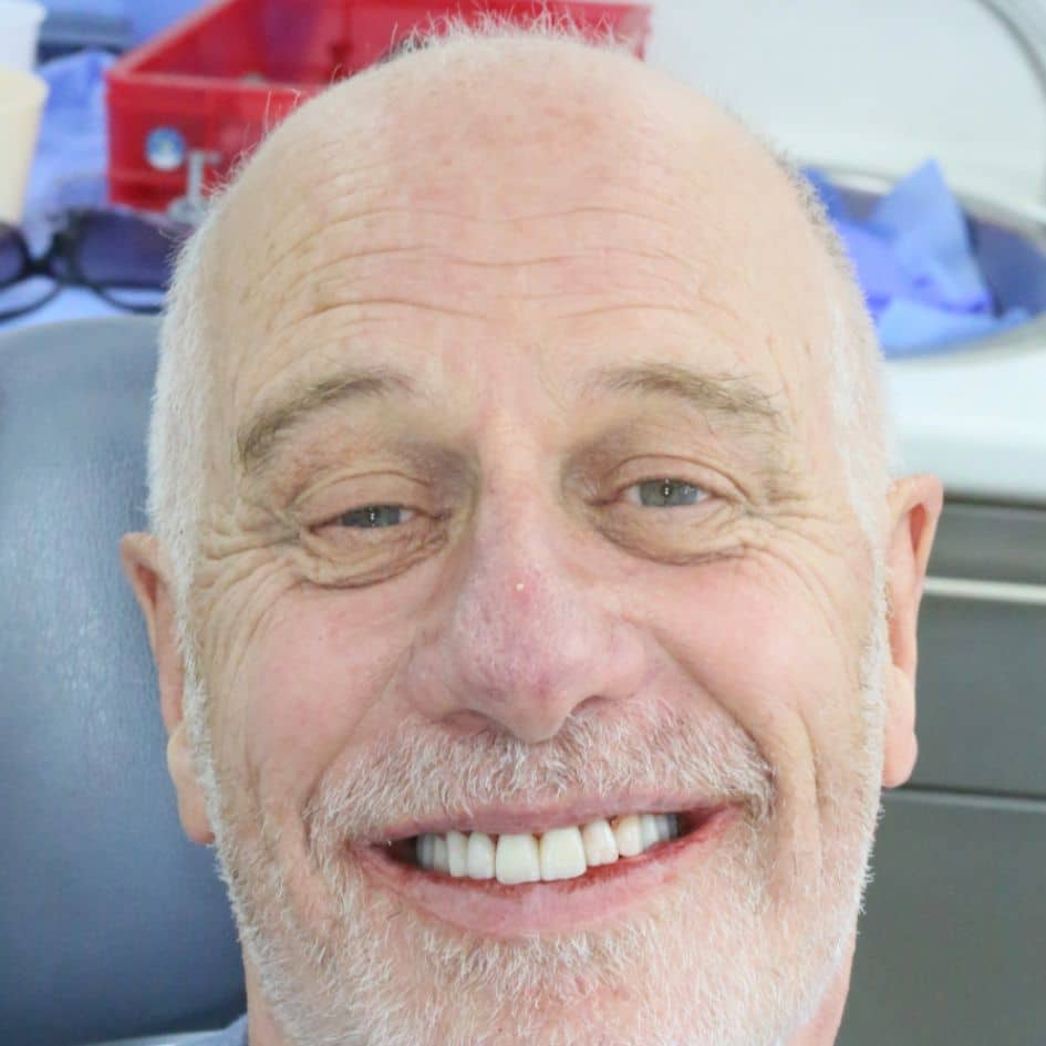 patient face picture after implant treatment in dentist leicester